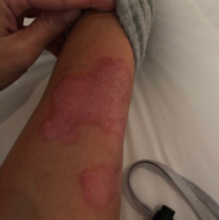 Kim Kardashian comparte impactantes imágenes de su cuerpo con psoriasis