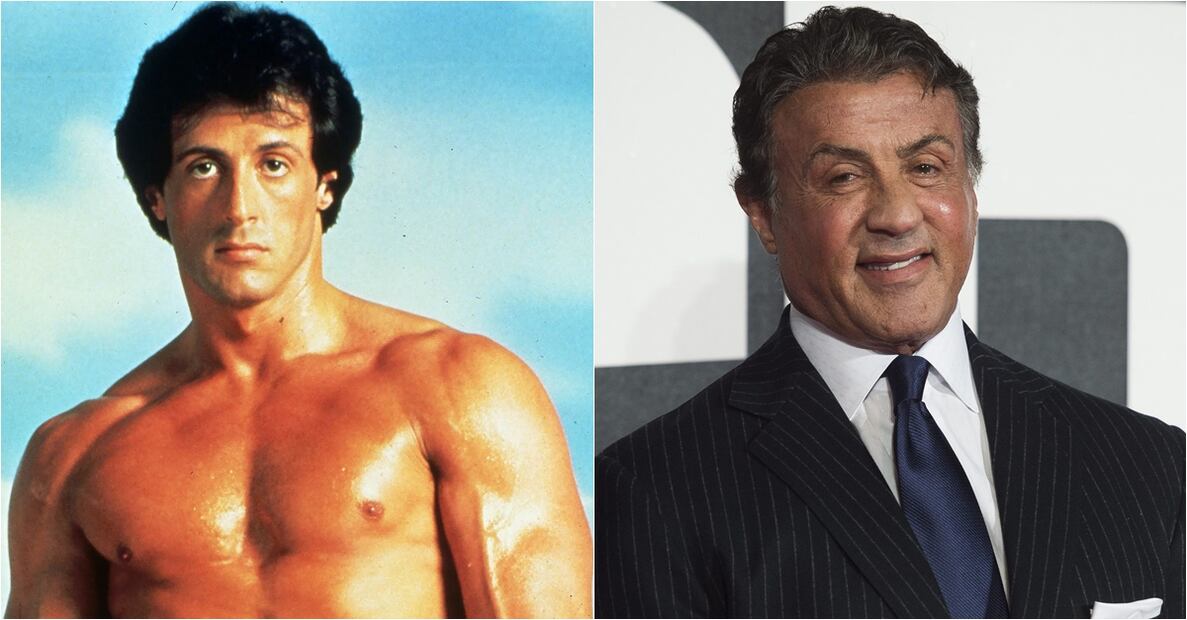 Famosos que deformaron sus rostros con cirugías plásticas