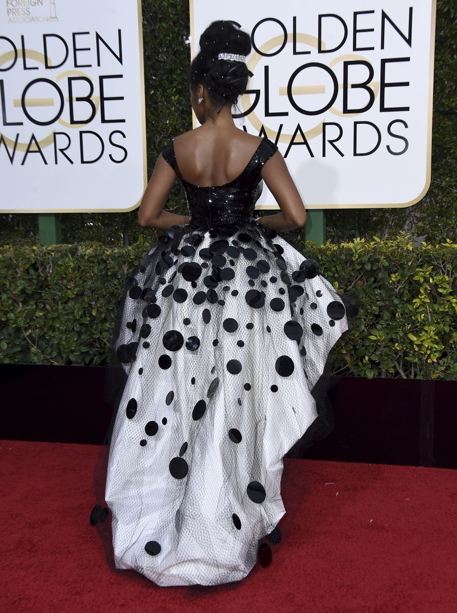Las celebridades peor vestidas de los Golden Globes 2017