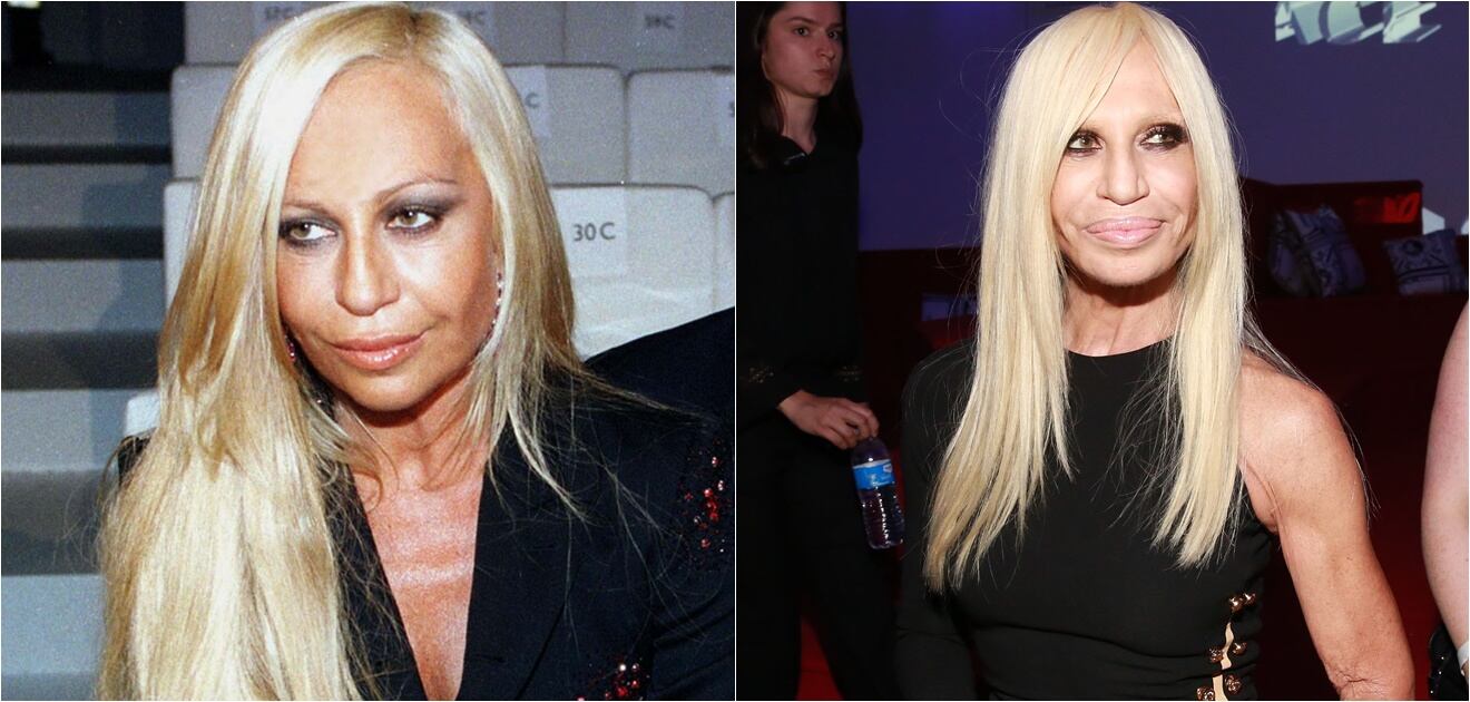 Famosos que cambiaron por completo sus rostros con cirugías o bótox