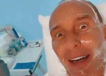 Érik Rubín revela cuál es el doloroso tratamiento que usa para evitar el envejecimiento