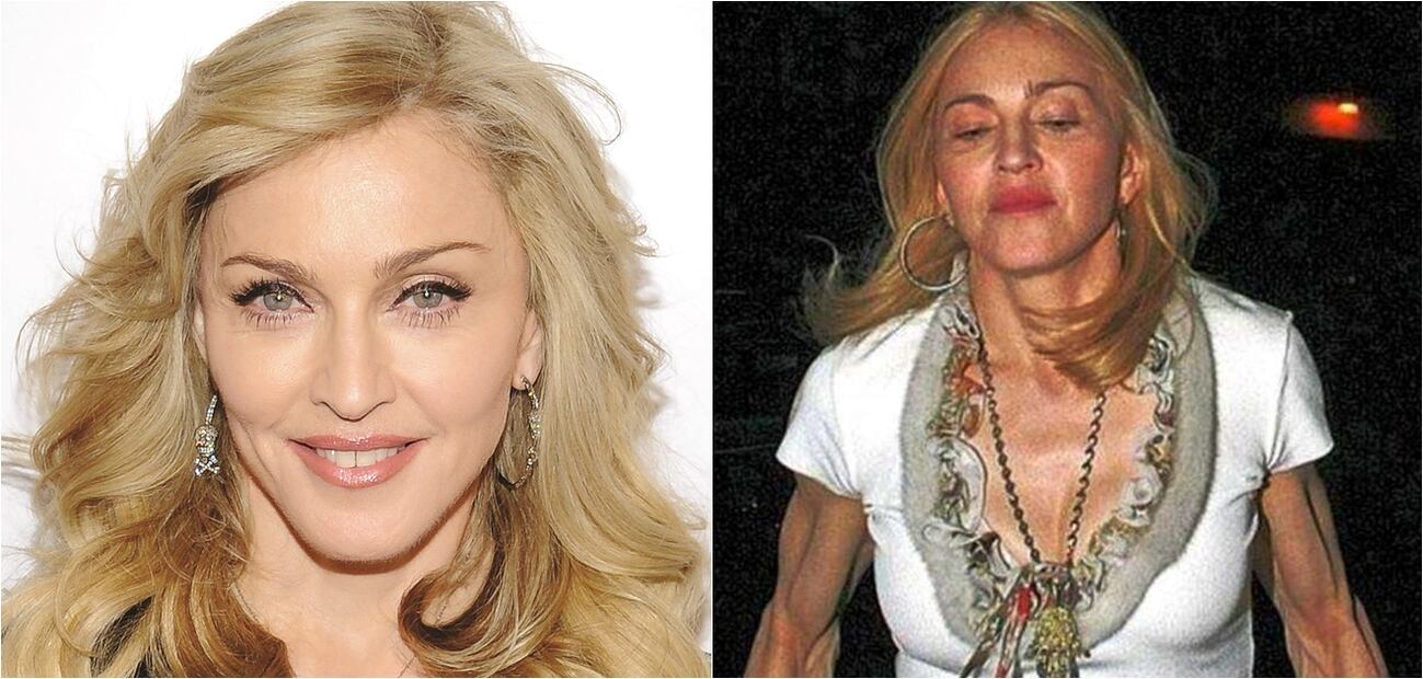 Las peores fotos de las celebridades