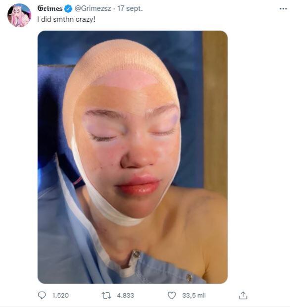 La rara transformación de Grimes luego de lucir la cara vendada