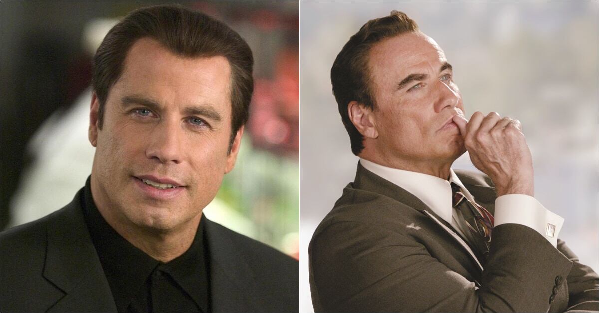 Famosos víctimas del botox 