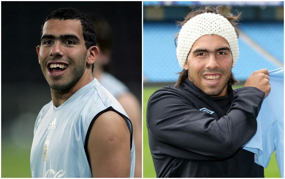 FOTOS: Antes y después de futbolistas que se operaron el rostro