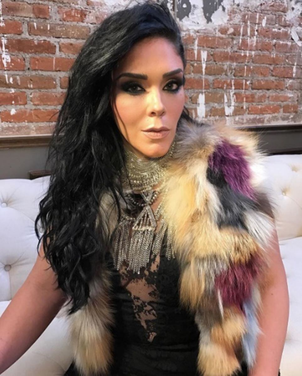 Famosas que pusieron en riesgo su salud por tratamientos estéticos