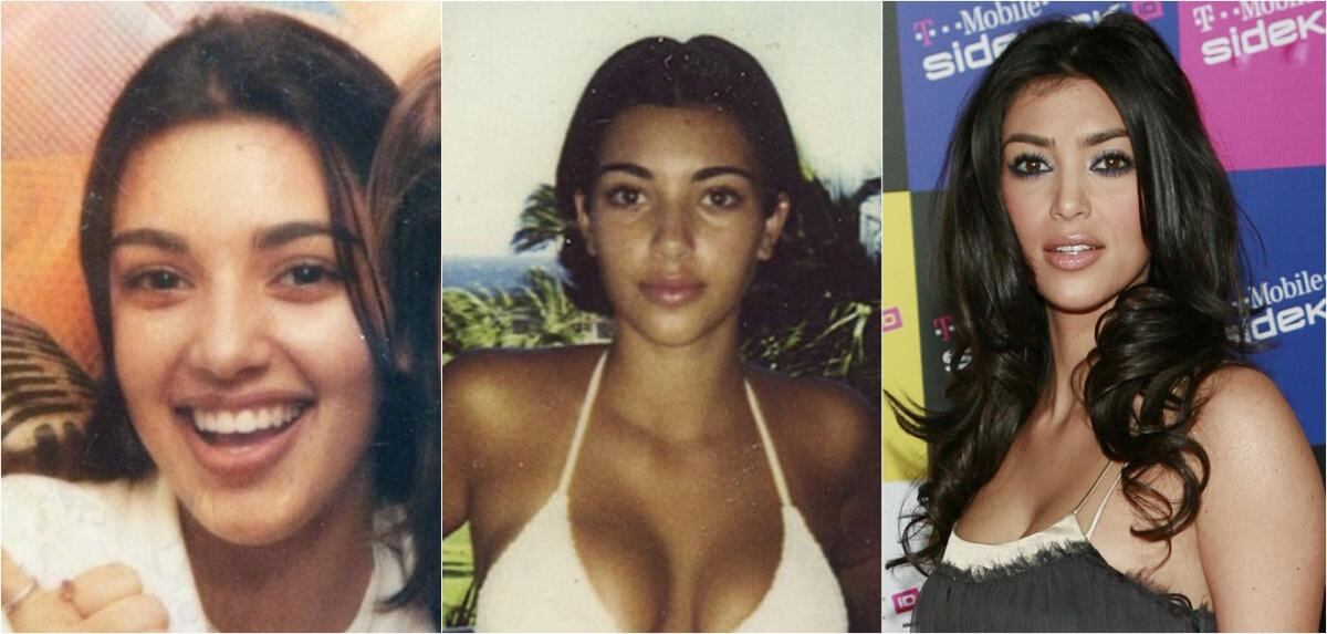 La transformación del rostro de Kim Kardashian 