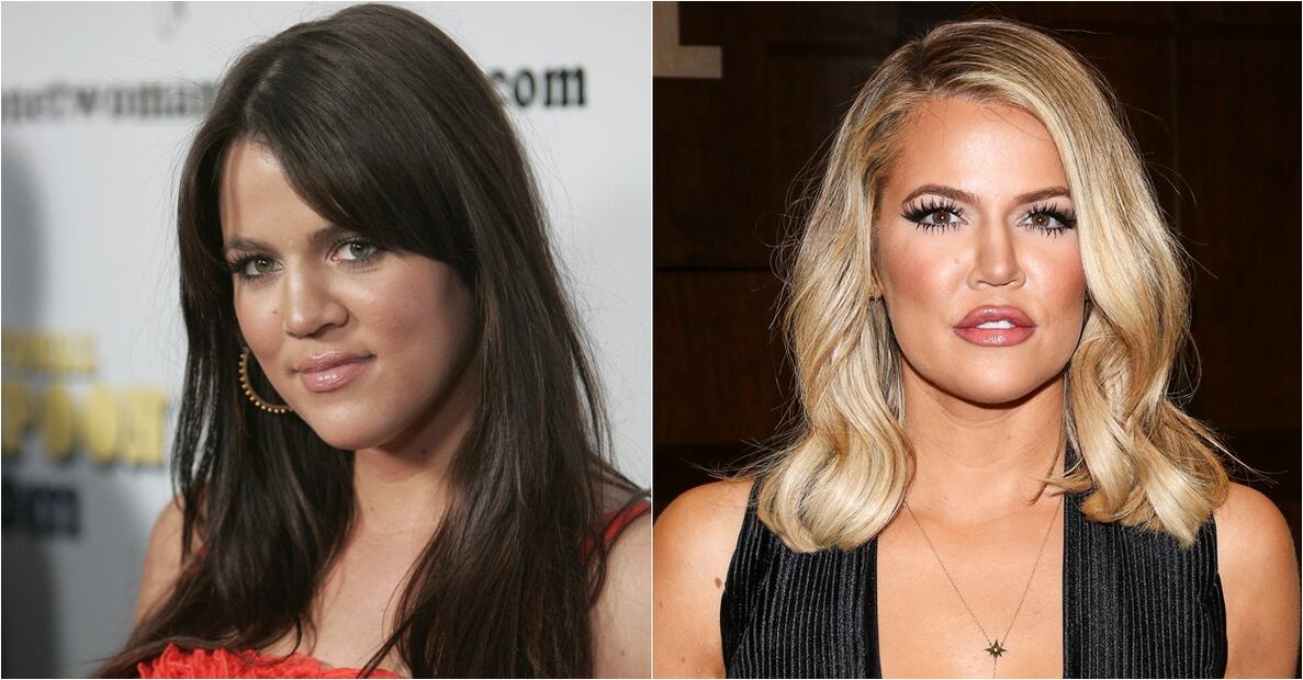 Las Kardashian antes y después del quirófano