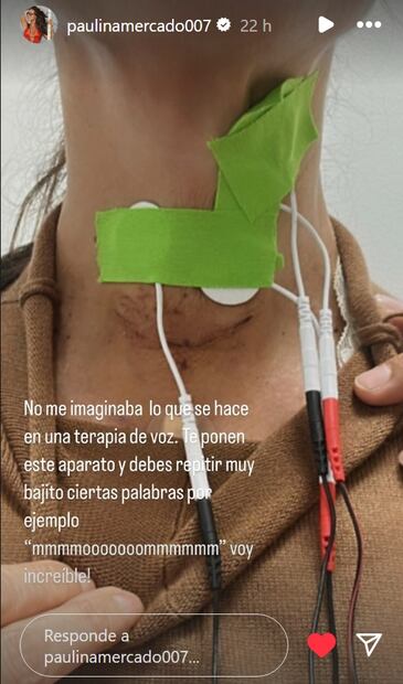 La recuperación de Paulina Mercado / Foto: Instagram