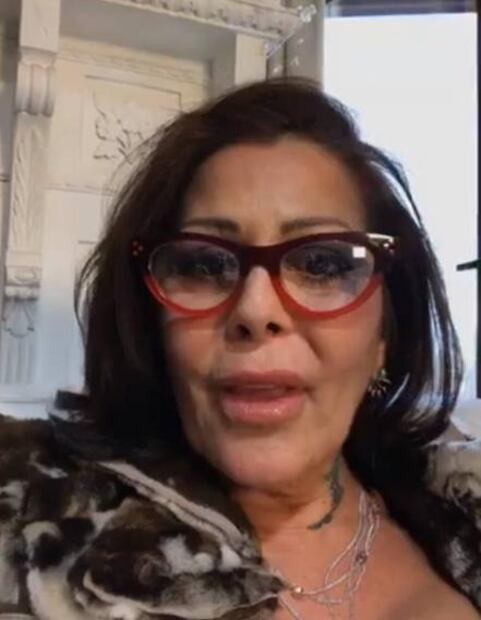 ¿Qué le pasó al rostro de la cantante Alejandra Guzmán? 