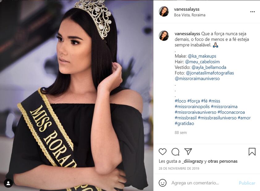 Muere reina de belleza en plena cirugía en Brasil; tenía 21 años