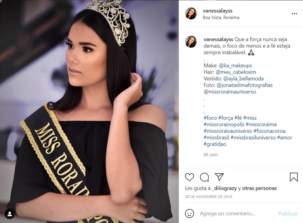 Muere reina de belleza en plena cirugía en Brasil; tenía 21 años