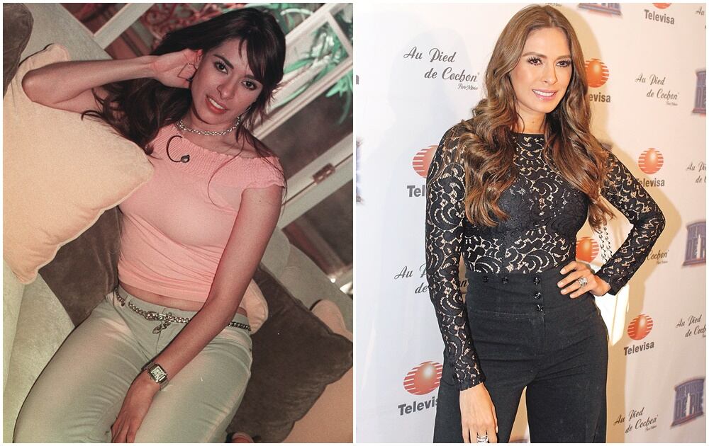 Famosos que cambiaron por completo sus rostros con cirugías o bótox