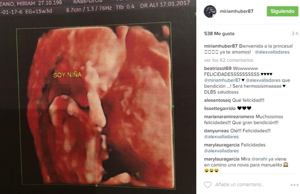 Revelan el sexo del primer bebé de Alejandro Valladares y Miriam Huber
