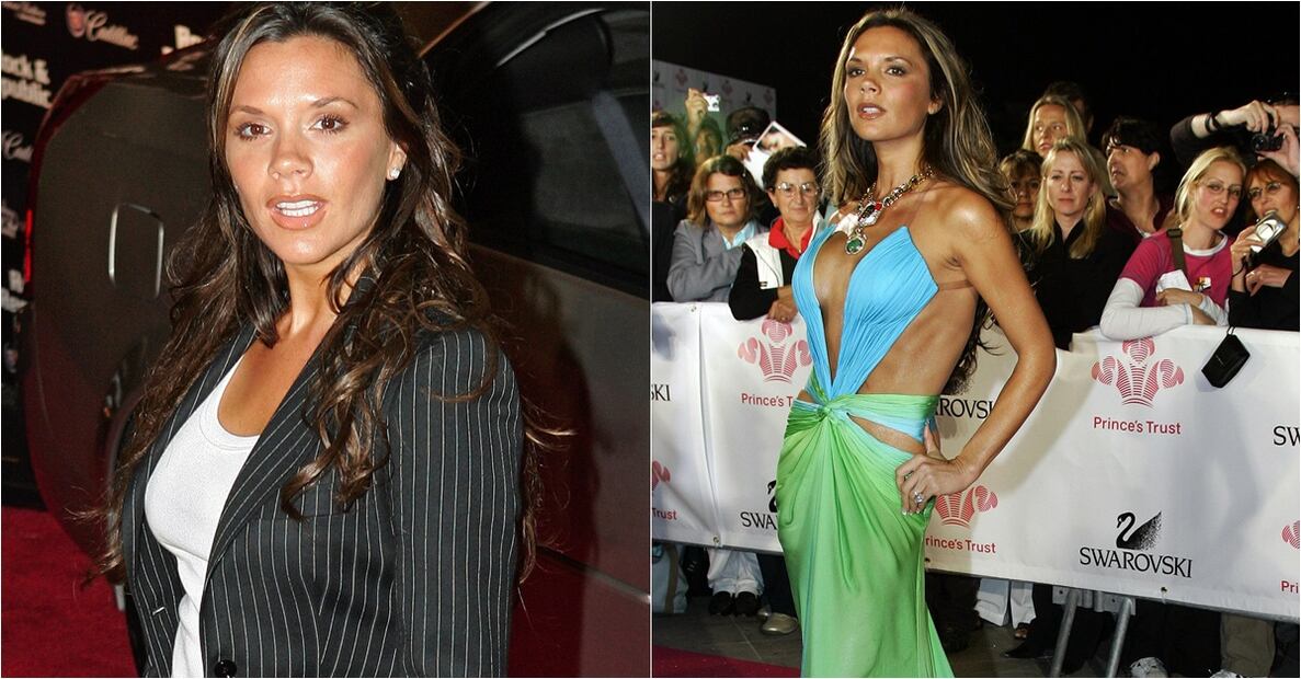 Las cirugías de Victoria Beckham 