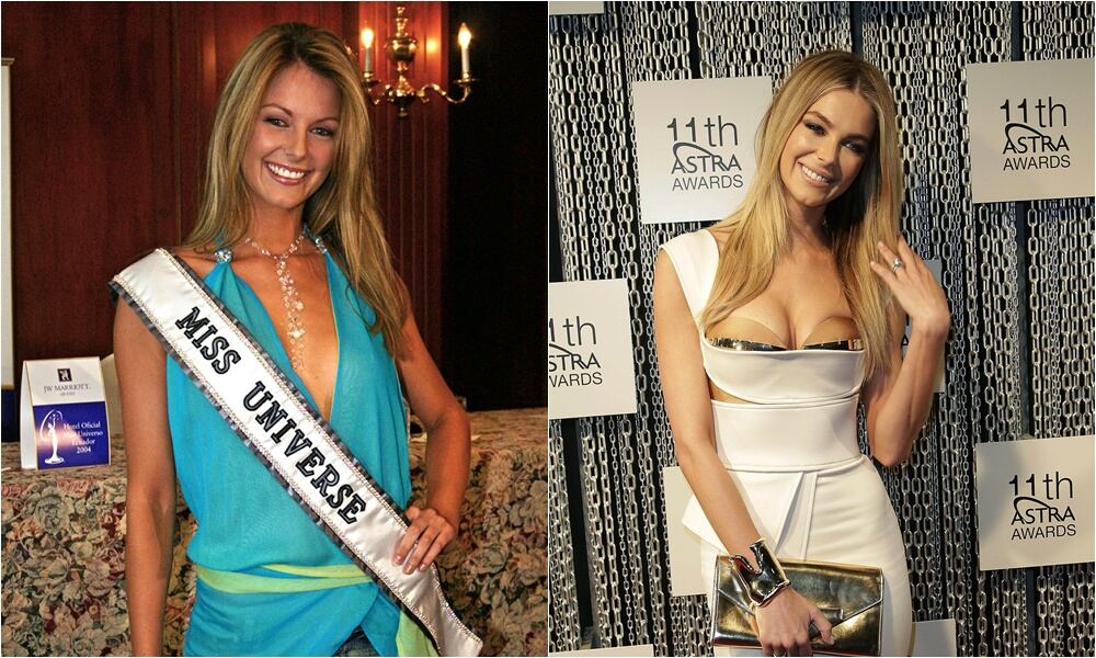 Las cirugías de las reinas de belleza