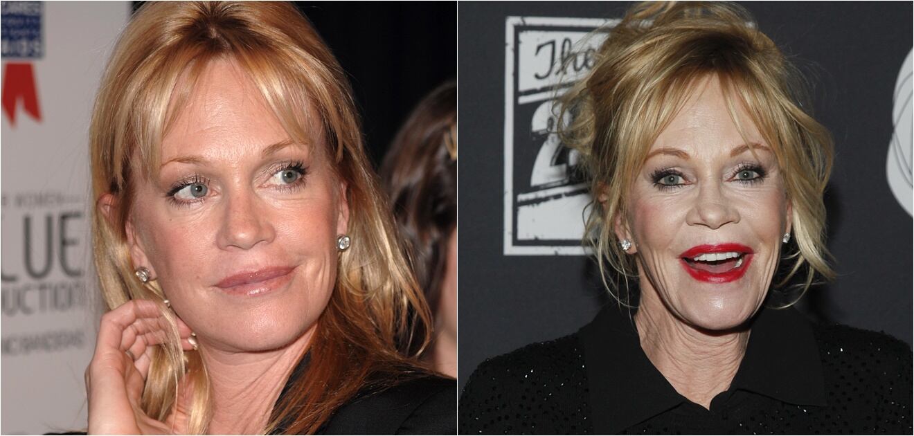 Famosos que envejecieron mal