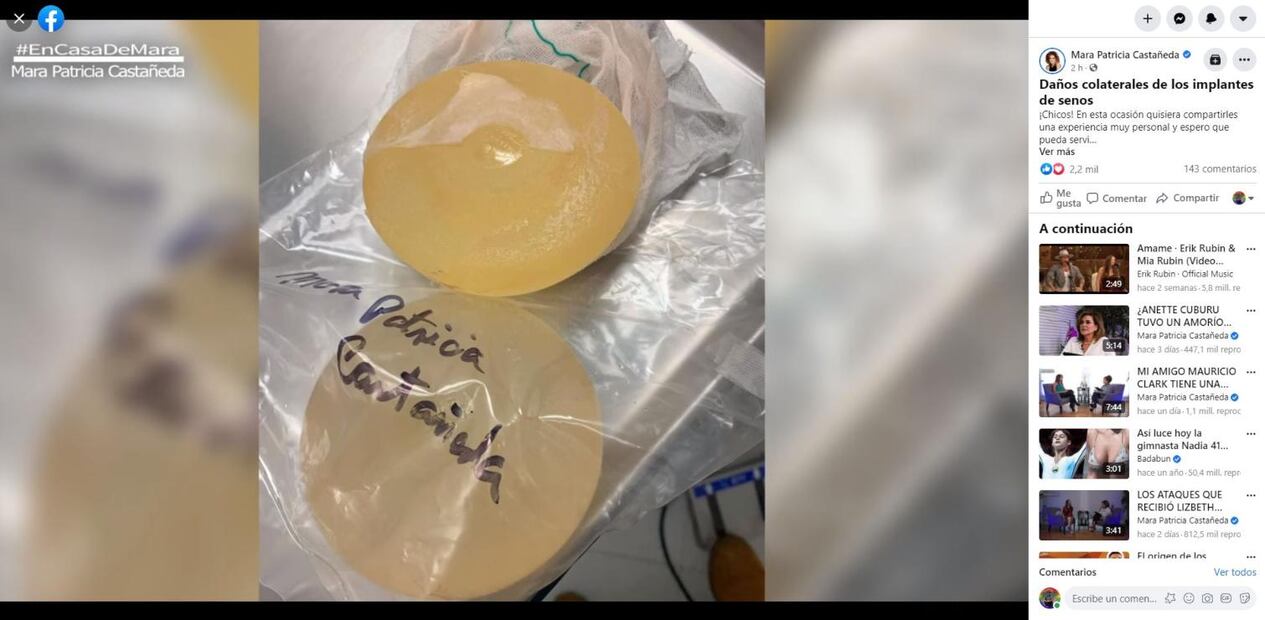 Mara Patricia Castañeda se retira implantes mamarios por problemas de salud