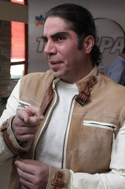 Estas han sido las visibles intervenciones quirúrgicas del empresario Jorge Kahwagi 