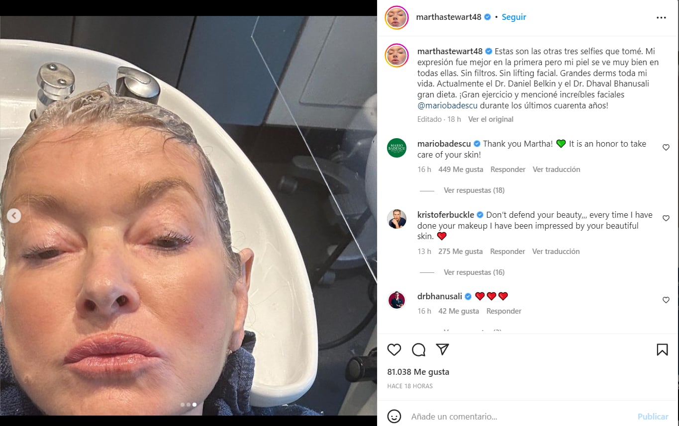 Martha Stewart, de 81 años, presume su cara libre de arrugas, "Sin filtros"