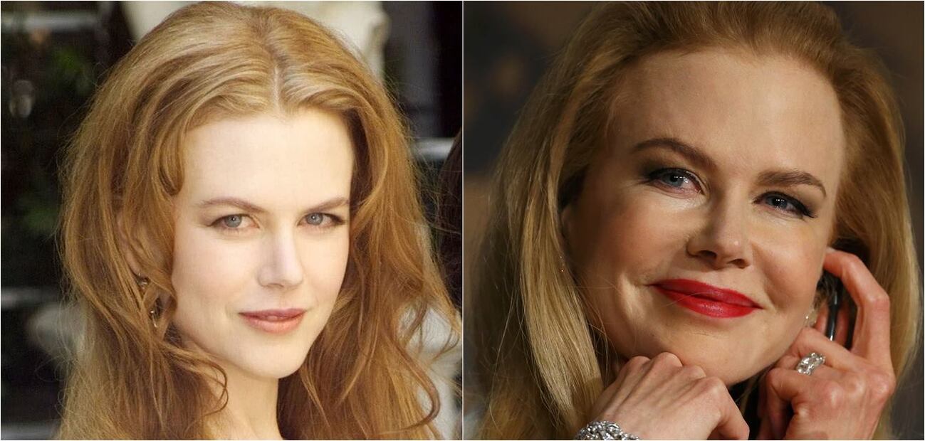 Las actrices de los 90 que se cambiaron el rostro 