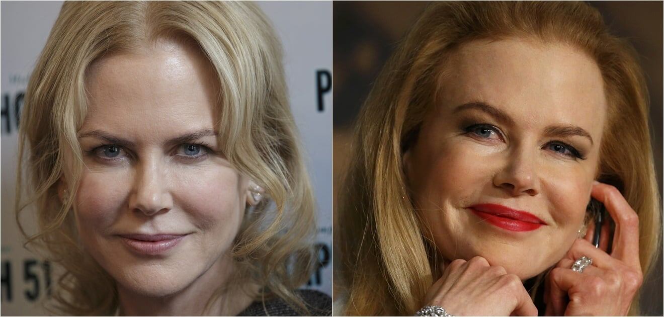 Famosos que cambiaron por completo sus rostros con cirugías o bótox