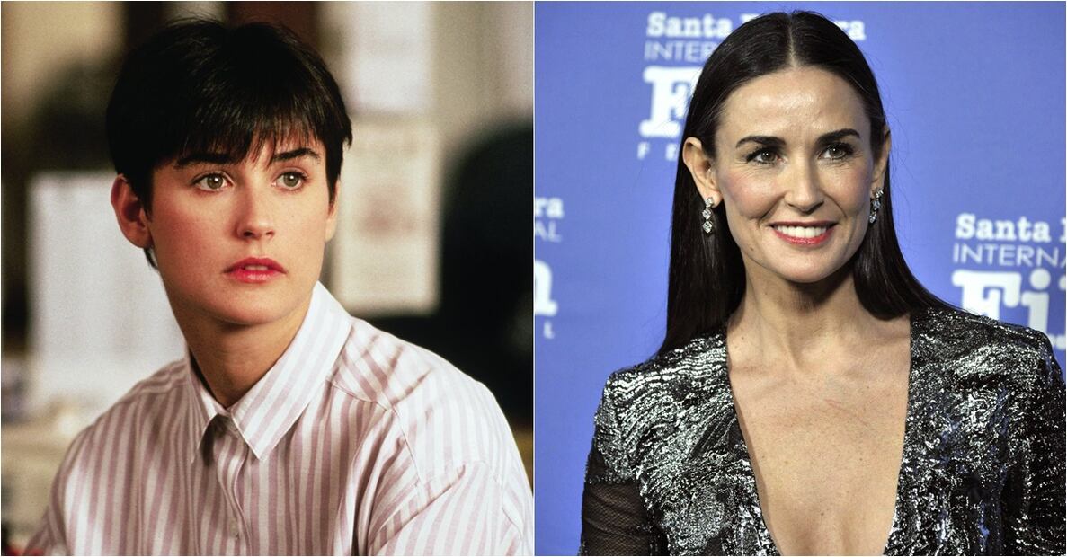 Famosos víctimas del botox 