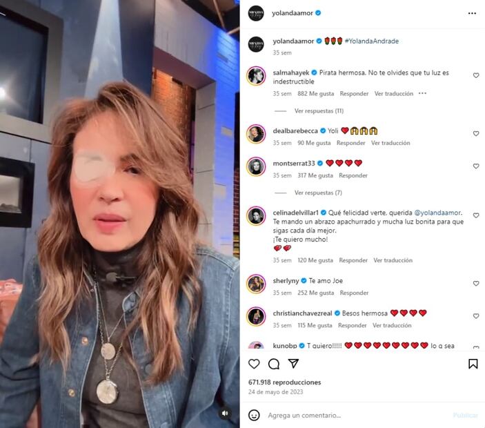 Yolanda Andrade / Foto: Instagram