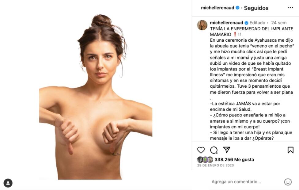 Instagram: @michellerenaud