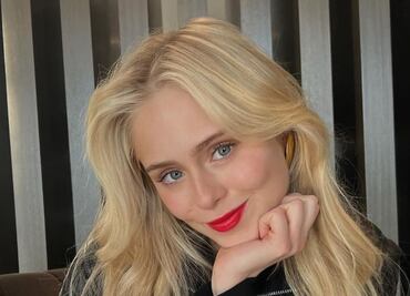 Loreto Peralta se reinventa y sorprende con audaz look sin cejas