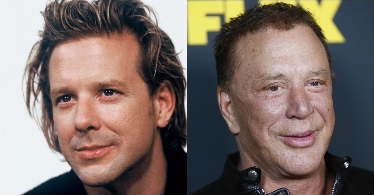 Famosos que cambiaron por completo sus rostros con cirugías o bótox