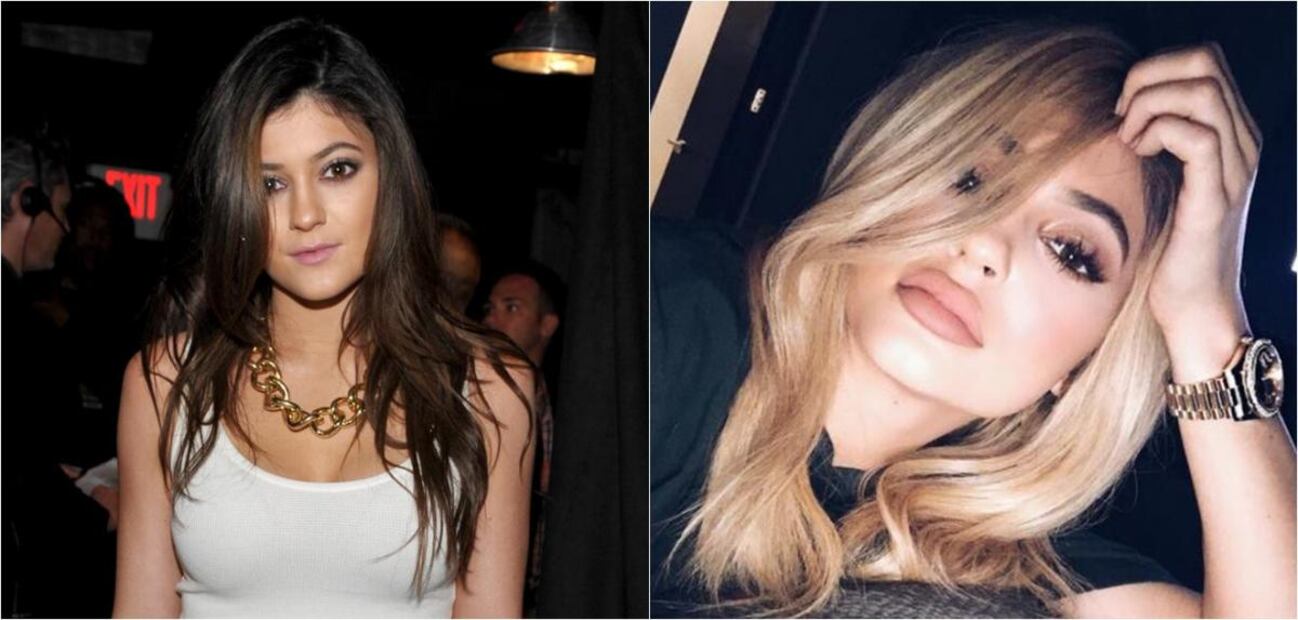 FOTOS: 5 famosas con labios sensuales gracias al bótox