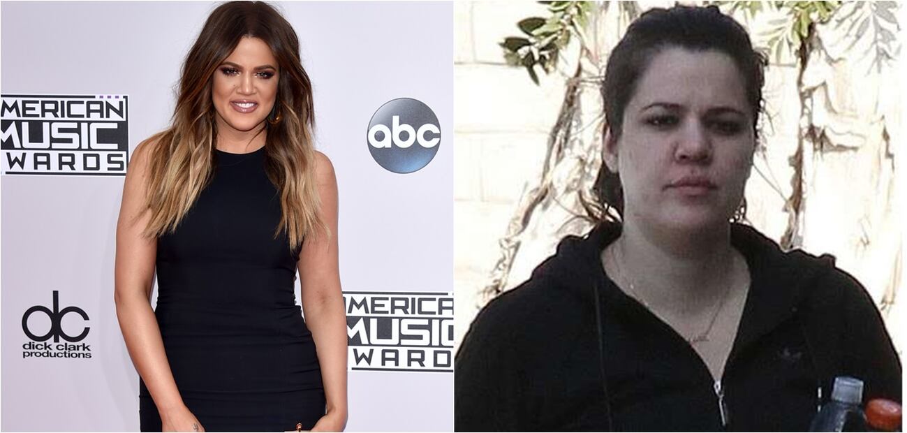Las peores fotos de las celebridades