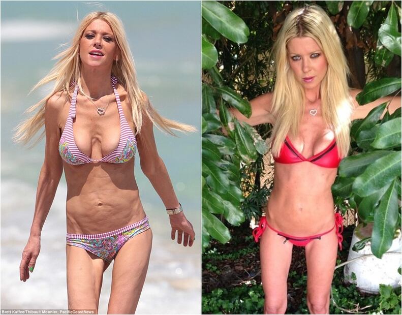 FOTOS: La delgada figura de Tara Reid en bikini