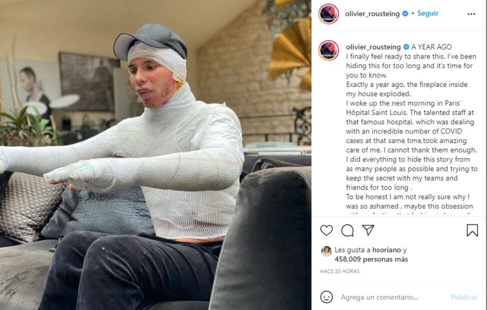 Oliver Rousteing, director creativo de Balmain, sufrió un brutal accidente