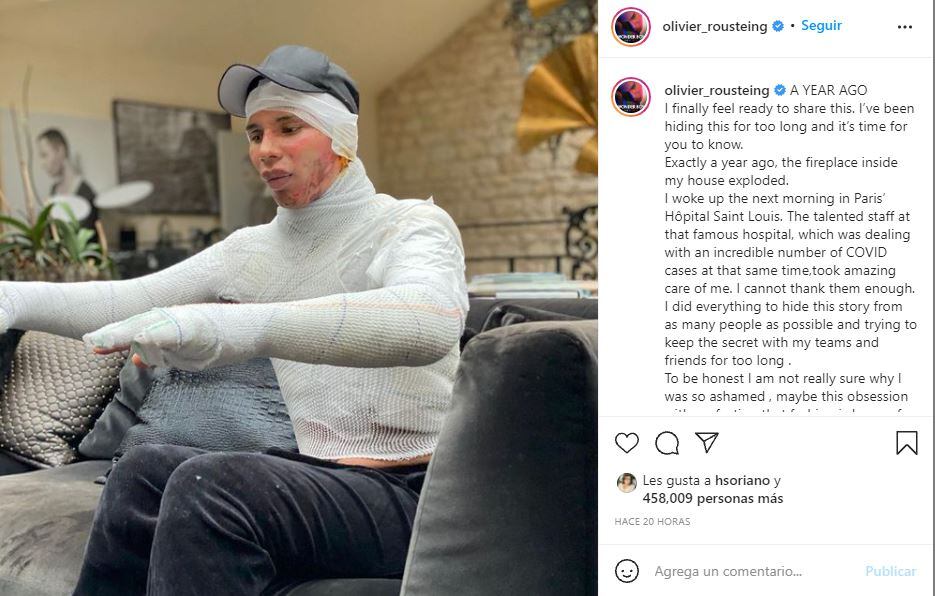 Oliver Rousteing, director creativo de Balmain, sufrió un brutal accidente