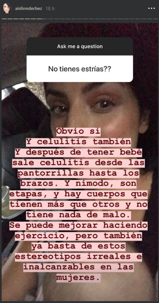 Aislinn Derbez acepta orgullosa tener celulitis y estrías 