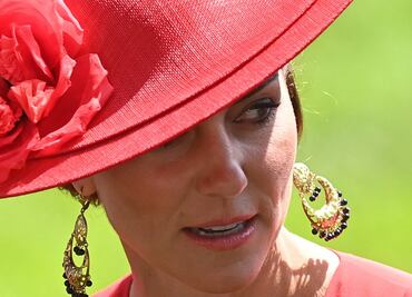Kate Middleton tuvo que ser hospitalizada para delicada cirugía; esto se sabe sobre su estado de salud