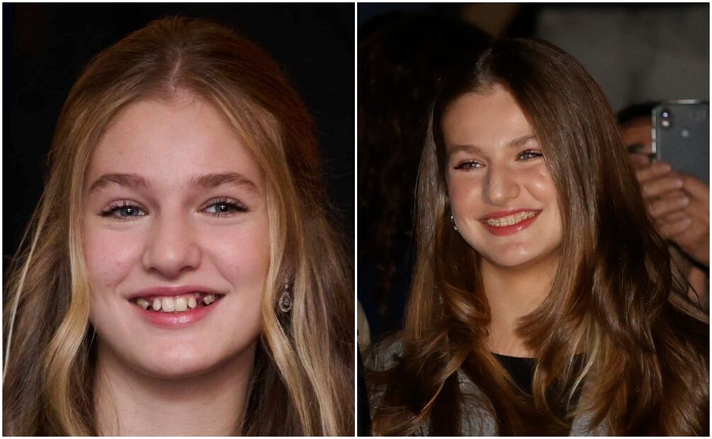 La princesa Leonor luce una sonrisa perfecta gracias a los avances en su tratamiento dental