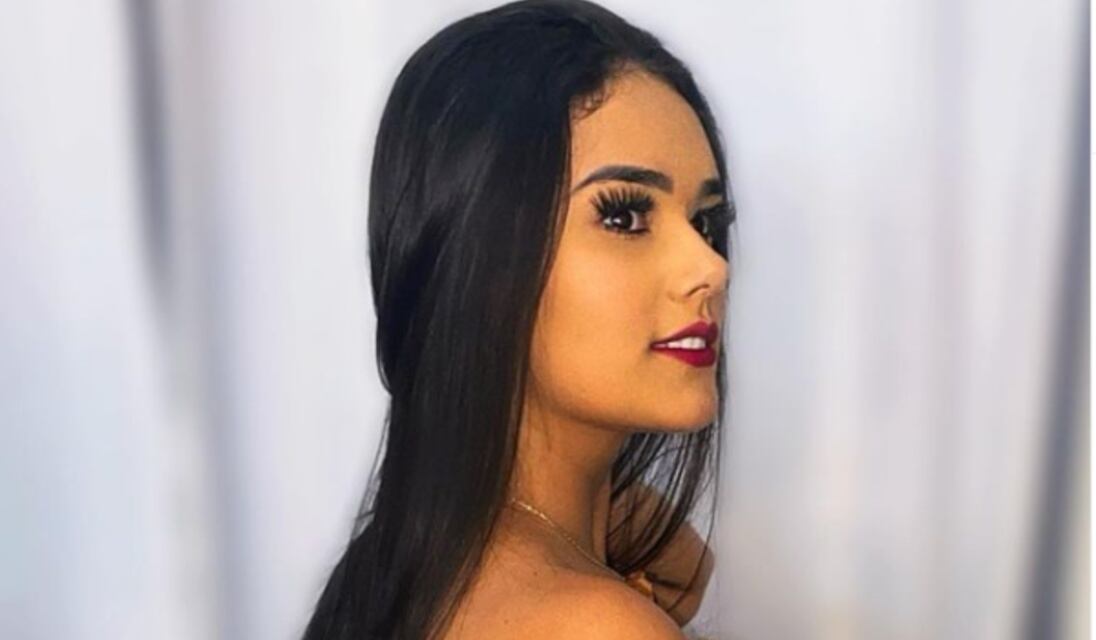 Muere reina de belleza en plena cirugía en Brasil; tenía 21 años