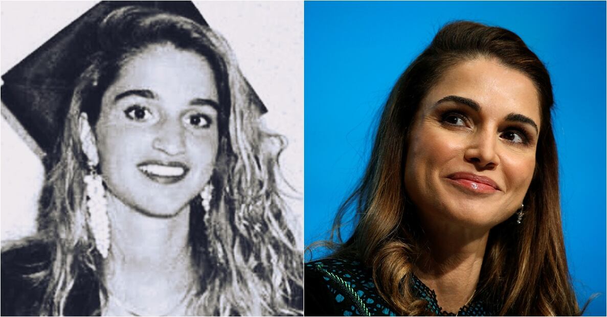 Las integrantes de la realeza que se han hecho cirugías estéticas 