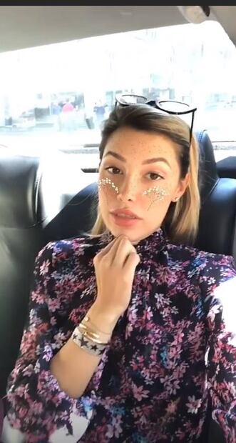 Sorprende Michelle Salas con nuevos labios