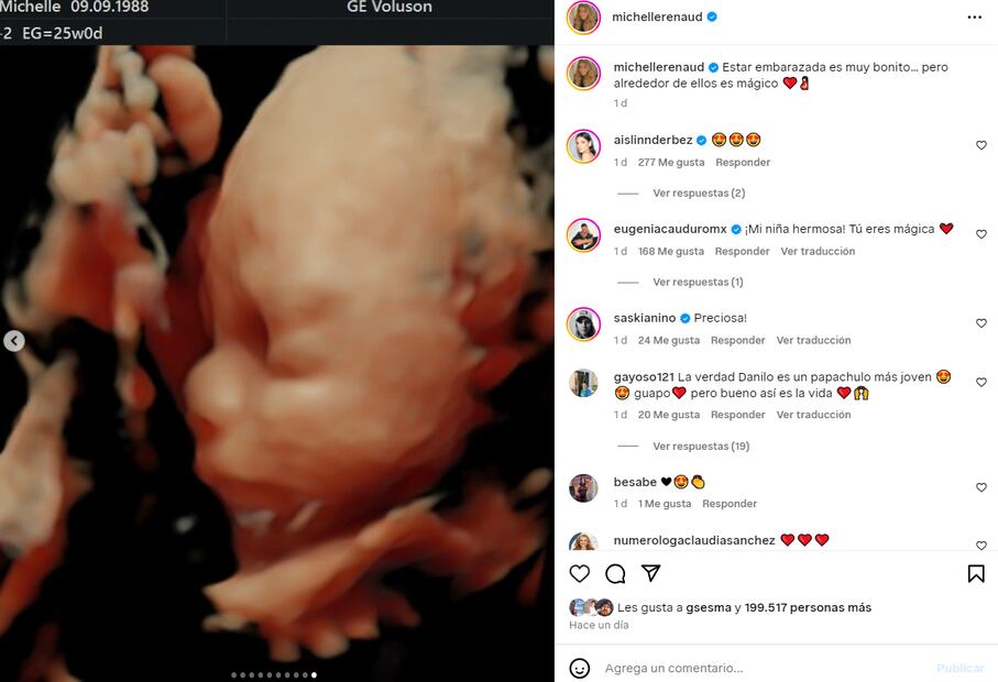 Bebé Michelle Renaud/Instagram