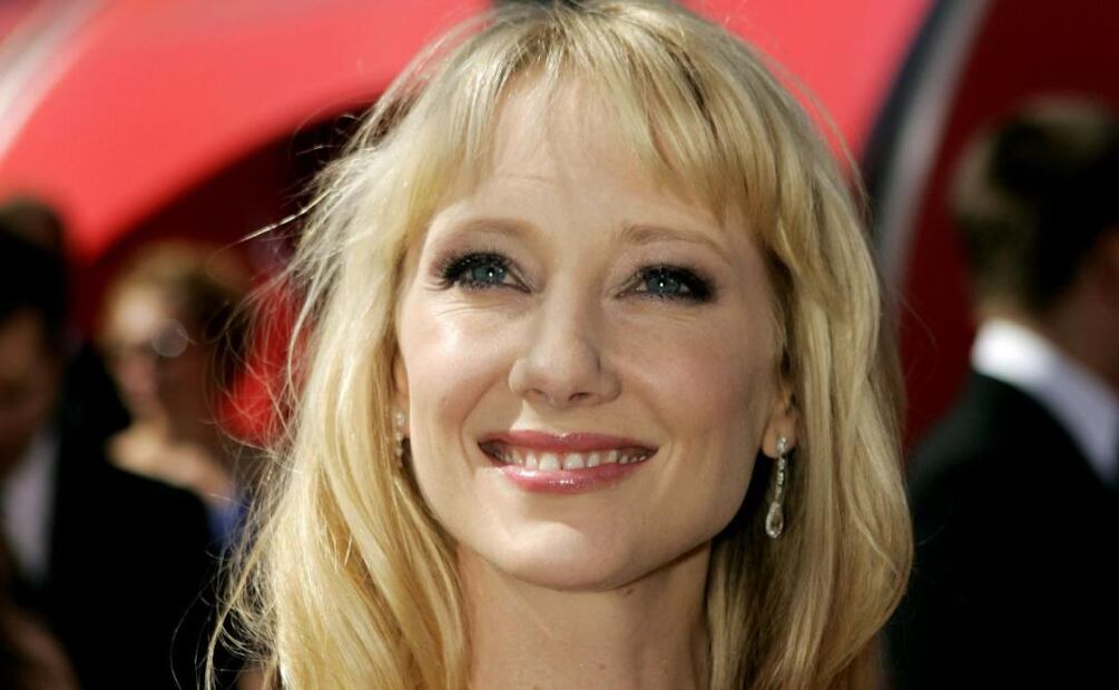 Anne Heche, sin esperanzas de sobrevivir