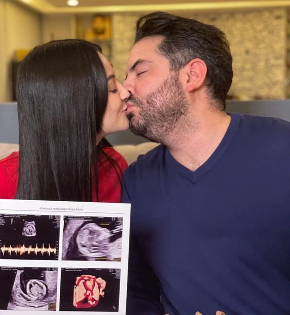 José Eduardo Derbez y su novia Paola Dalay anunciar su embarazo / Instagram