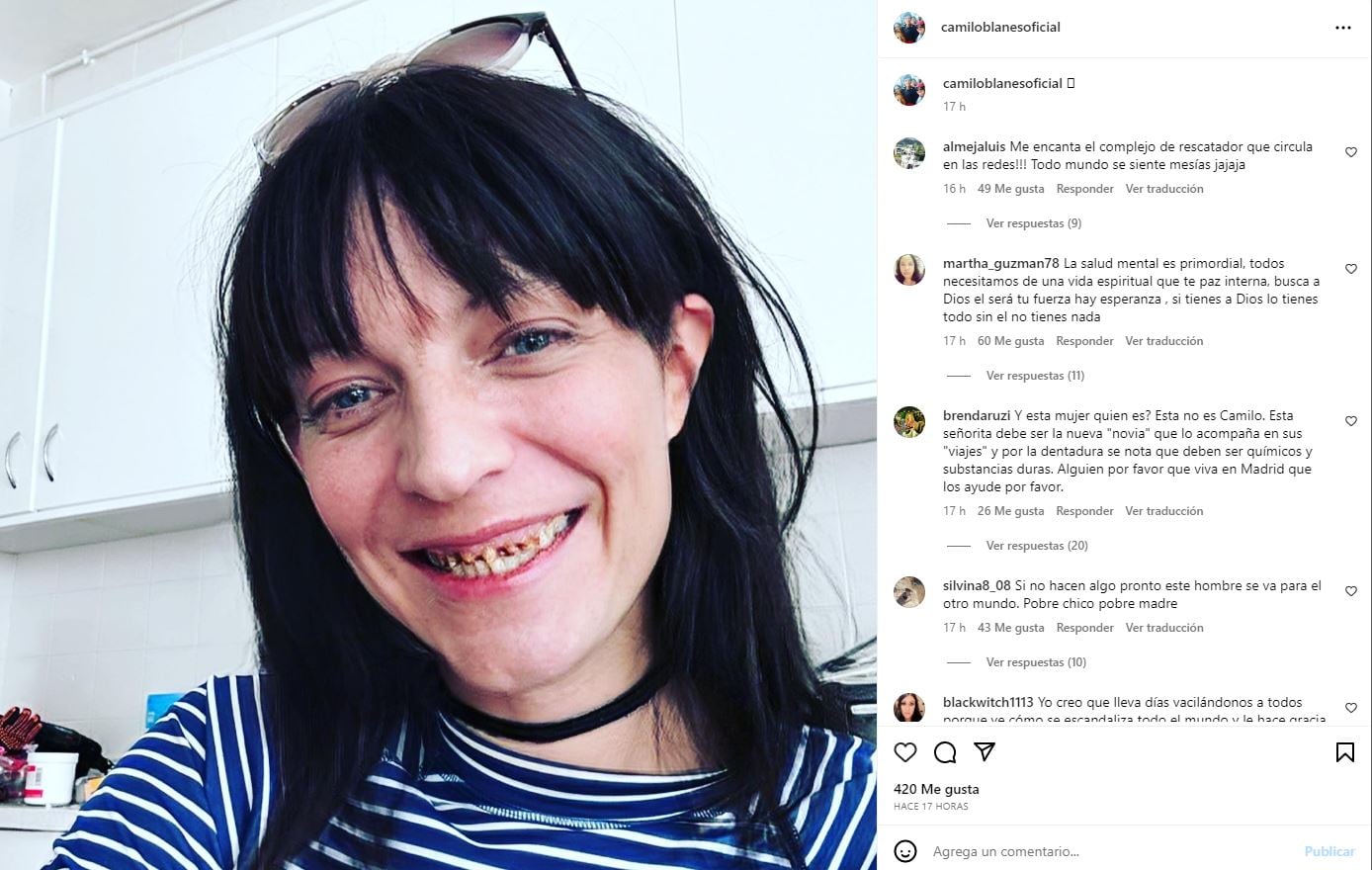 Las últimas fotos de Camilo Blanes: sin dientes, con cigarro y entre desorden