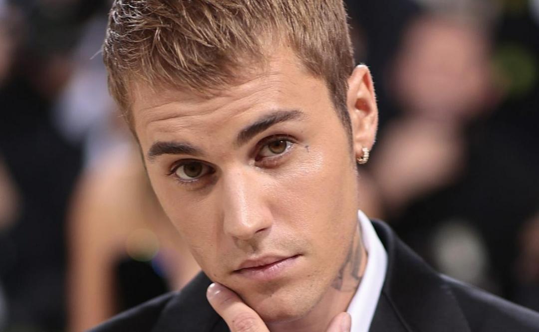 Justin Bieber, con la cara paralizada, suplica oraciones por su salud