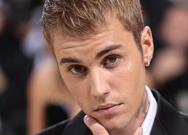 Justin Bieber, con la cara paralizada, suplica oraciones por su salud