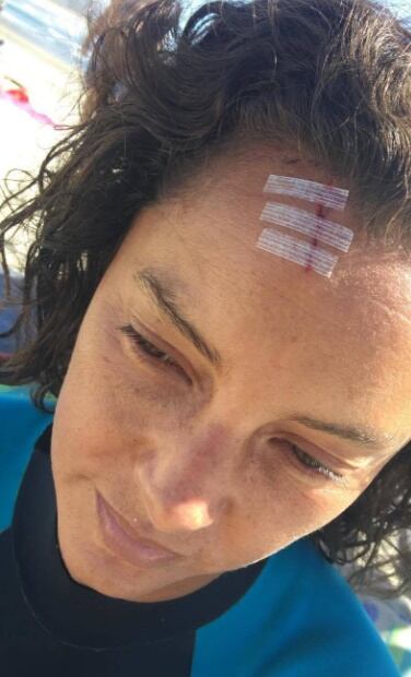 FOTOS: Así quedó Sara Maldonado tras sufrir accidente 