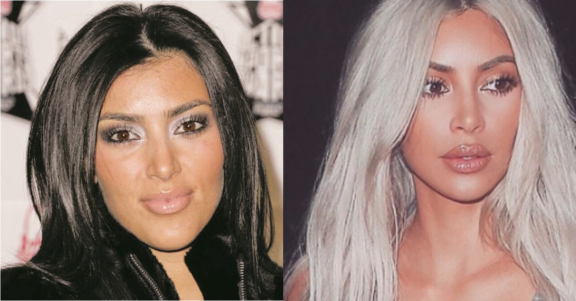 Las Kardashian antes y después del quirófano